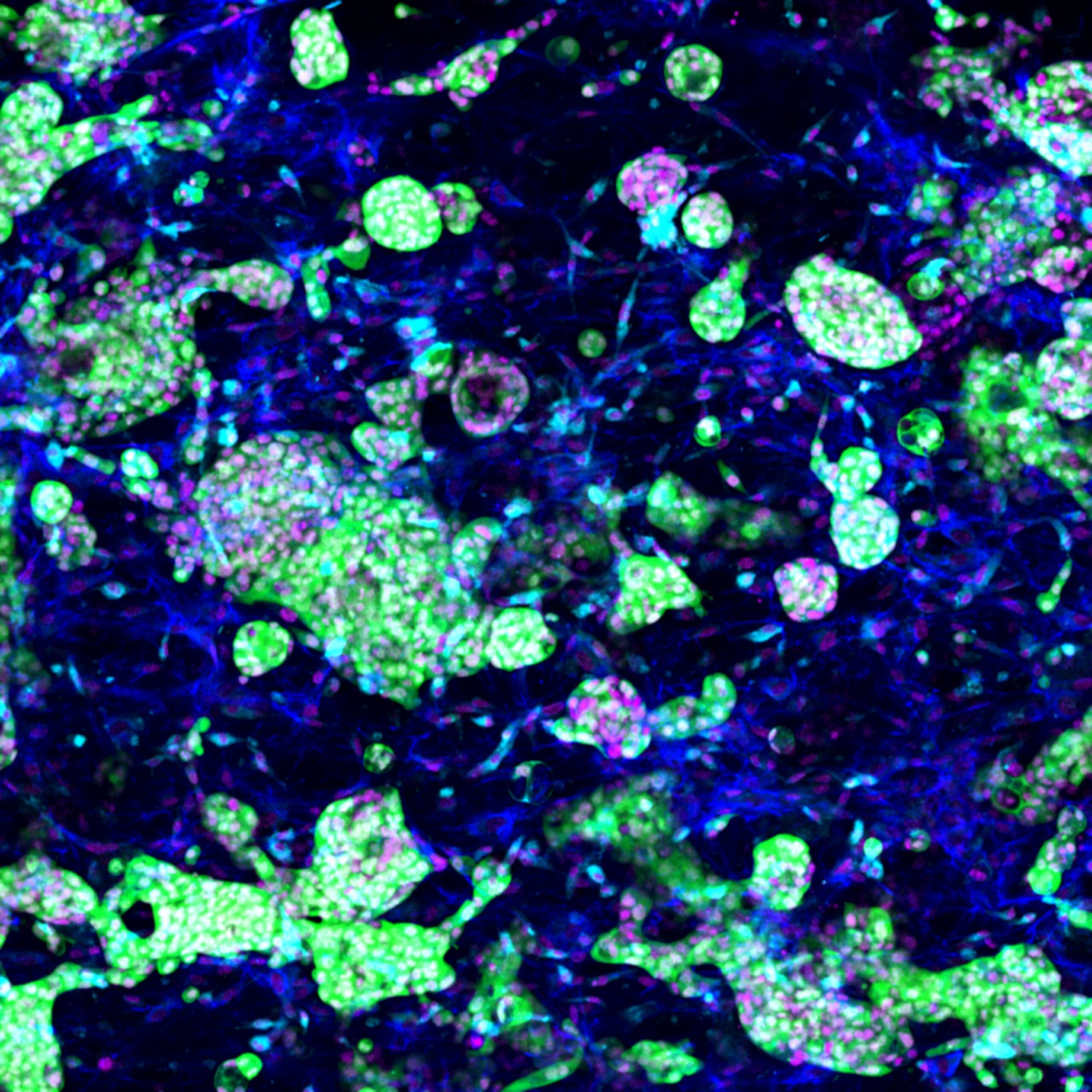 The Cell Pond With reference to the painting by Claude Monet, the cell pond represents a 3D in vitro niche of the tumour-stromal interface in pancreatic cancer. The niche consists of patient-derived pancreatic cancer organoids (green), cancer-associated fibroblasts (blue), and tumour-associated macrophages (cyan). Cell nuclei are captured in pink.