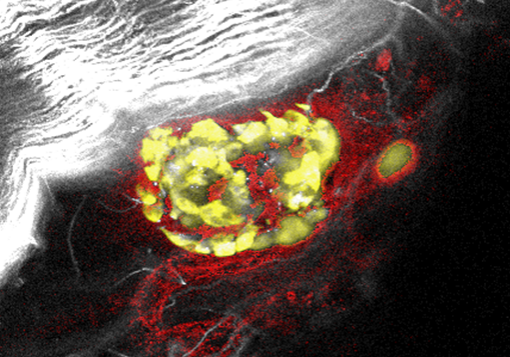 Transplanted-islet-featured-image